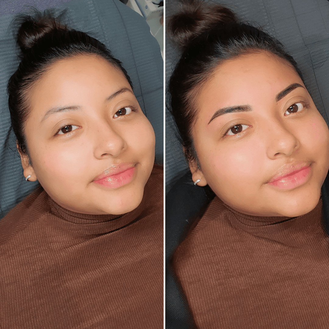 PMU removal specialist