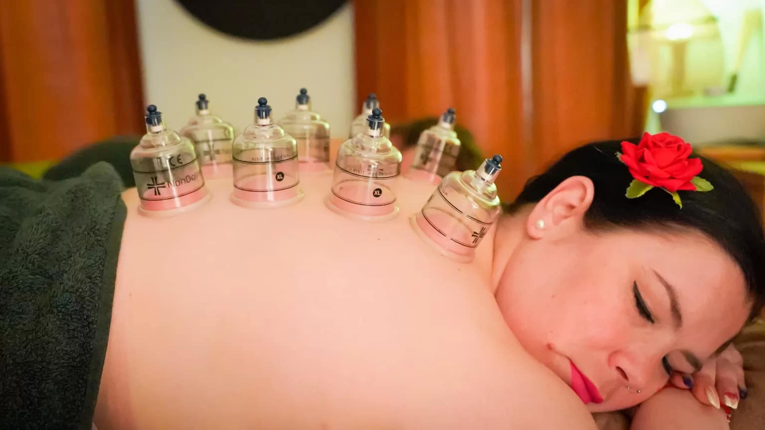 Cupping therapy in Amsterdam De Pijp at Beauty Lounge – relieve muscle tension and improve circulation.