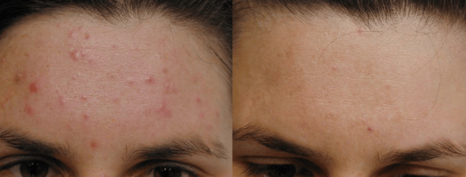 20200610_220124_0000