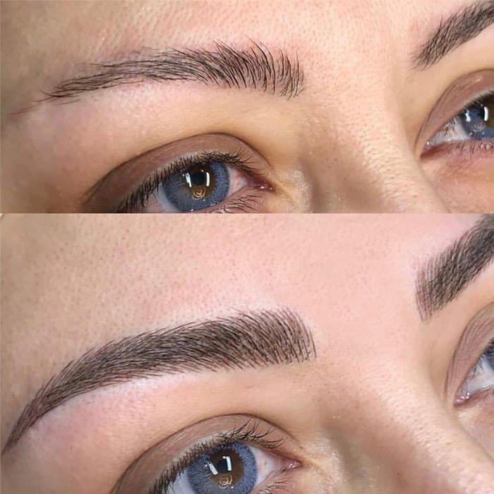 Eyebrow tattoo removal Amsterdam