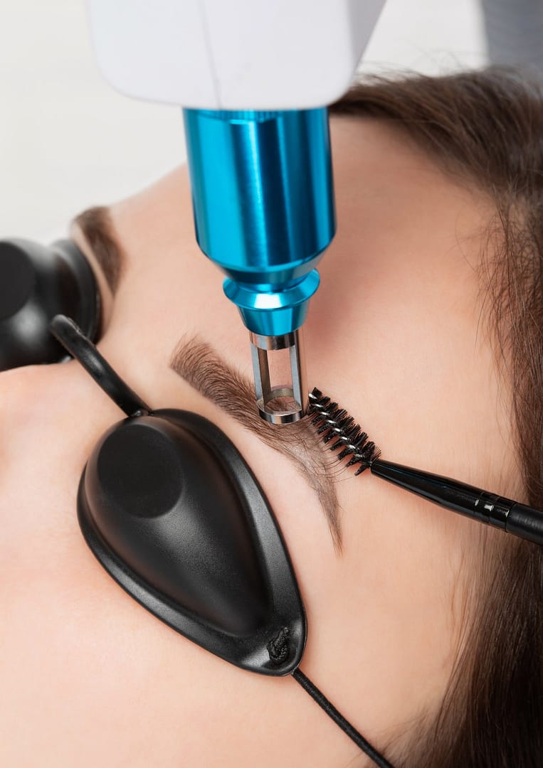 eyebrow tattoo removal amsterdam