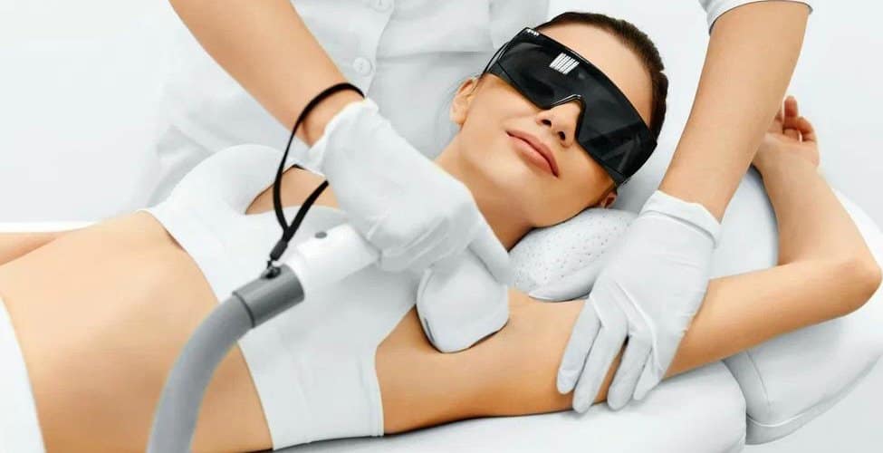 Laser hair removal